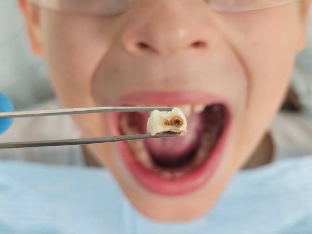 Best Urgent Dental Care for Toothache in White Hall, AR