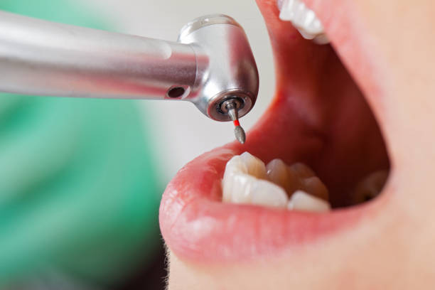 Best Emergency Dental Extractions in White Hall, AR